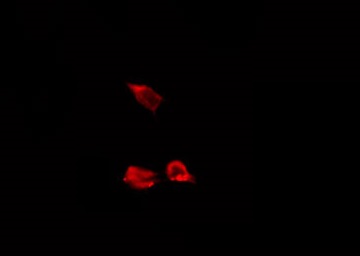CAPNS1 / CAPN4 Antibody - Staining HeLa cells by IF/ICC. The samples were fixed with PFA and permeabilized in 0.1% Triton X-100, then blocked in 10% serum for 45 min at 25°C. The primary antibody was diluted at 1:200 and incubated with the sample for 1 hour at 37°C. An Alexa Fluor 594 conjugated goat anti-rabbit IgG (H+L) Ab, diluted at 1/600, was used as the secondary antibody.