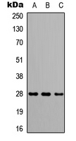 CAPNS2 Antibody - Western blot analysis of CAPNS2 expression in HeLa (A); NS-1 (B); H9C2 (C) whole cell lysates.