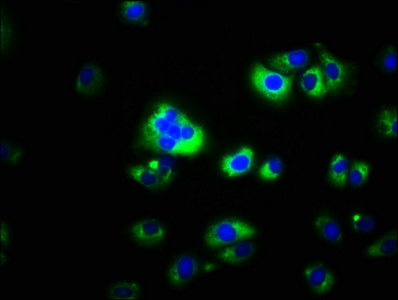 CAPNS2 Antibody - Immunofluorescence staining of A549 cells with CAPNS2 Antibody at 1:100, counter-stained with DAPI. The cells were fixed in 4% formaldehyde, permeabilized using 0.2% Triton X-100 and blocked in 10% normal Goat Serum. The cells were then incubated with the antibody overnight at 4°C. The secondary antibody was Alexa Fluor 488-congugated AffiniPure Goat Anti-Rabbit IgG(H+L).