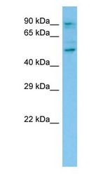CAPRIN1 Antibody - CAPRIN1 antibody Western Blot of 293T cell lysate.  This image was taken for the unconjugated form of this product. Other forms have not been tested.