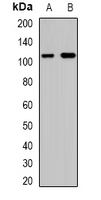 CAPRIN1 Antibody - Western blot analysis of Caprin1 expression in HeLa (A); Jurkat (B) whole cell lysates.