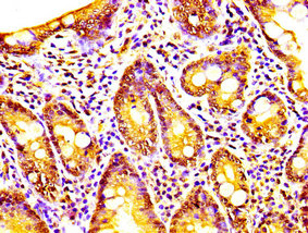 CAPRIN1 Antibody - Immunohistochemistry image at a dilution of 1:200 and staining in paraffin-embedded human small intestine tissue performed on a Leica BondTM system. After dewaxing and hydration, antigen retrieval was mediated by high pressure in a citrate buffer (pH 6.0) . Section was blocked with 10% normal goat serum 30min at RT. Then primary antibody (1% BSA) was incubated at 4 °C overnight. The primary is detected by a biotinylated secondary antibody and visualized using an HRP conjugated SP system.