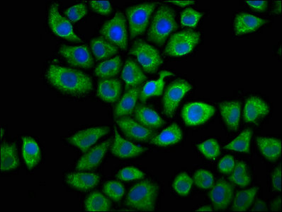CAPRIN1 Antibody - Immunofluorescence staining of Hela cells with CAPRIN1 Antibody at 1:66, counter-stained with DAPI. The cells were fixed in 4% formaldehyde, permeabilized using 0.2% Triton X-100 and blocked in 10% normal Goat Serum. The cells were then incubated with the antibody overnight at 4°C. The secondary antibody was Alexa Fluor 488-congugated AffiniPure Goat Anti-Rabbit IgG(H+L).