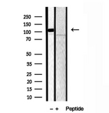 CAPRIN1 Antibody - Western blot analysis of extracts of HeLa and ND7 cells using CAPRIN1 antibody.