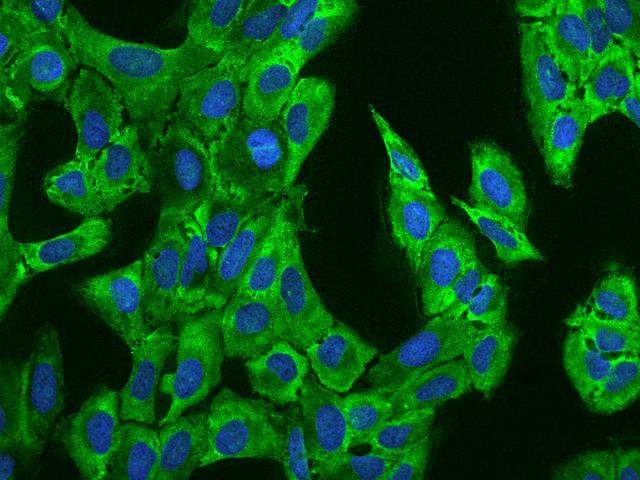 CAPRIN1 Antibody - Immunofluorescence staining of CAPRIN1 in U2OS cells. Cells were fixed with 4% PFA, permeabilzed with 0.1% Triton X-100 in PBS, blocked with 10% serum, and incubated with rabbit anti-Human CAPRIN1 polyclonal antibody (dilution ratio 1:100) at 4°C overnight. Then cells were stained with the Alexa Fluor 488-conjugated Goat Anti-rabbit IgG secondary antibody (green) and counterstained with DAPI (blue). Positive staining was localized to Cytoplasm.