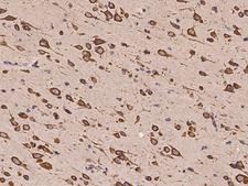CAPRIN1 Antibody - Immunochemical staining of human CAPRIN1 in human brain with rabbit polyclonal antibody at 1:100 dilution, formalin-fixed paraffin embedded sections.