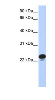 CAPS Antibody - CAPS antibody Western blot of 293T cell lysate. This image was taken for the unconjugated form of this product. Other forms have not been tested.