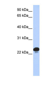 CAPS Antibody - CAPS antibody Western blot of 293T cell lysate. This image was taken for the unconjugated form of this product. Other forms have not been tested.
