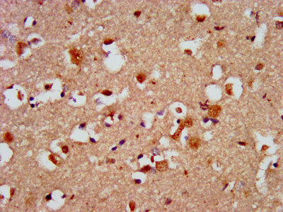 CAPS2 Antibody - Immunohistochemistry image at a dilution of 1:500 and staining in paraffin-embedded human brain tissue performed on a Leica BondTM system. After dewaxing and hydration, antigen retrieval was mediated by high pressure in a citrate buffer (pH 6.0) . Section was blocked with 10% normal goat serum 30min at RT. Then primary antibody (1% BSA) was incubated at 4 °C overnight. The primary is detected by a biotinylated secondary antibody and visualized using an HRP conjugated SP system.