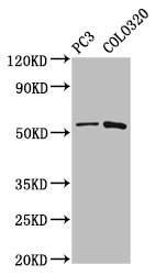 CAPS2 Antibody - Positive Western Blot detected in PC3 whole cell lysate, Colo320 whole cell lysate. All lanes: CAPS2 antibody at 5.2 µg/ml Secondary Goat polyclonal to rabbit IgG at 1/50000 dilution. Predicted band size: 64, 45, 34 KDa. Observed band size: 64 KDa