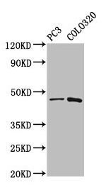 CAPS2 Antibody - Western Blot Positive WB detected in: PC-3 whole cell lysate, Colo320 whole cell lysate All lanes: CAPS2 antibody at 5.2µg/ml Secondary Goat polyclonal to rabbit IgG at 1/50000 dilution Predicted band size: 64, 45, 34 kDa Observed band size: 45 kDa