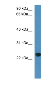 CAPSL Antibody - CAPSL antibody Western blot of Rat Liver lysate. This image was taken for the unconjugated form of this product. Other forms have not been tested.