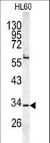 CAPZA1 / CAPZ Alpha 1 Antibody - Western blot of CAPZA1 antibody in HL60 cell line lysates (35 ug/lane). CAPZA1 (arrow) was detected using the purified antibody.