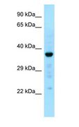 CAPZA1 / CAPZ Alpha 1 Antibody - CAPZA1 / CAPZ antibody Western Blot of Fetal Liver.  This image was taken for the unconjugated form of this product. Other forms have not been tested.