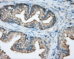 CAPZA1 / CAPZ Alpha 1 Antibody - IHC of paraffin-embedded prostate tissue using anti-CAPZA1 mouse monoclonal antibody. (Dilution 1:50).