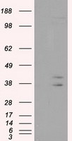 CAPZA1 / CAPZ Alpha 1 Antibody - HEK293T cells were transfected with the pCMV6-ENTRY control (Left lane) or pCMV6-ENTRY CAPZA1 (Right lane) cDNA for 48 hrs and lysed. Equivalent amounts of cell lysates (5 ug per lane) were separated by SDS-PAGE and immunoblotted with anti-CAPZA1.