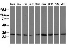 CAPZA1 / CAPZ Alpha 1 Antibody - Western blot analysis of extracts (35ug) from 9 different cell lines by using anti-CAPZA1 monoclonal antibody.