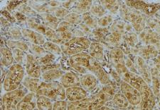 CAPZA1 / CAPZ Alpha 1 Antibody - 1:100 staining mouse kidney tissue by IHC-P. The sample was formaldehyde fixed and a heat mediated antigen retrieval step in citrate buffer was performed. The sample was then blocked and incubated with the antibody for 1.5 hours at 22°C. An HRP conjugated goat anti-rabbit antibody was used as the secondary.