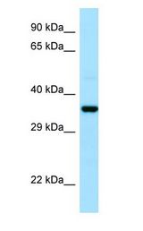 CAPZA1 / CAPZ Alpha 1 Antibody - CAPZA1 / CAPZ antibody Western Blot of Fetal Lung.  This image was taken for the unconjugated form of this product. Other forms have not been tested.