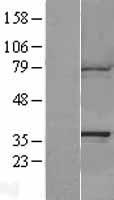 CAPZA1 / CAPZ Alpha 1 Protein - Western validation with an anti-DDK antibody * L: Control HEK293 lysate R: Over-expression lysate
