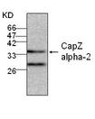 CAPZA2 / CAPZ Alpha 2 Antibody