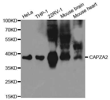 CAPZA2 / CAPZ Alpha 2 Antibody - Western blot analysis of extracts of various cell lines.