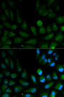 CAPZA2 / CAPZ Alpha 2 Antibody - Immunofluorescence analysis of HepG2 cells.