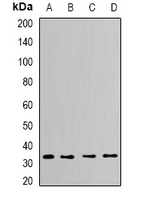 CAPZA2 / CAPZ Alpha 2 Antibody - Western blot analysis of CapZ alpha-2 expression in HeLa (A); THP1 (B); mouse brain (C); mouse heart (D) whole cell lysates.