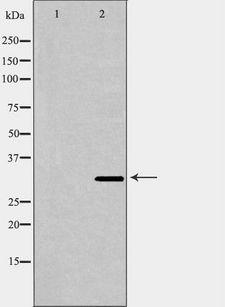 CAPZA2 / CAPZ Alpha 2 Antibody - Western blot analysis of HeLa whole cells lysates using CAPZA2 antibody. The lane on the left is treated with the antigen-specific peptide.