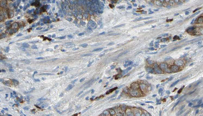CAPZA2 / CAPZ Alpha 2 Antibody - 1:100 staining human prostate tissue by IHC-P. The sample was formaldehyde fixed and a heat mediated antigen retrieval step in citrate buffer was performed. The sample was then blocked and incubated with the antibody for 1.5 hours at 22°C. An HRP conjugated goat anti-rabbit antibody was used as the secondary.