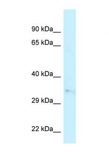 CAPZA2 / CAPZ Alpha 2 Antibody - CAPZA2 antibody Western blot of Fetal Heart lysate. Antibody concentration 1 ug/ml.  This image was taken for the unconjugated form of this product. Other forms have not been tested.
