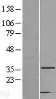CAPZA2 / CAPZ Alpha 2 Protein - Western validation with an anti-DDK antibody * L: Control HEK293 lysate R: Over-expression lysate