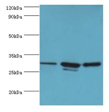 CAPZB / CAPZ Beta Antibody - Western blot. All lanes: CAPZB antibody at 6 ug/ml. Lane 1: 293T whole cell lysate. Lane 2: A431 whole cell lysate. Lane 3: Jurkat whole cell lysate. Secondary antibody: Goat polyclonal to rabbit at 1:10000 dilution. Predicted band size: 31 kDa. Observed band size: 31 kDa.