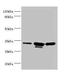 CAPZB / CAPZ Beta Antibody - Western blot All lanes: CAPZB antibody at 6µg/ml Lane 1: 293T whole cell lysate Lane 2: A431 whole cell lysate Lane 3: Jurkat whole cell lysate Secondary Goat polyclonal to rabbit IgG at 1/10000 dilution Predicted band size: 32, 31 kDa Observed band size: 32, 31 kDa