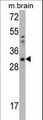 CAPZB / CAPZ Beta Antibody - Western blot of CAPZB Antibody in mouse brain tissue lysates (35 ug/lane). CAPZB (arrow) was detected using the purified antibody.