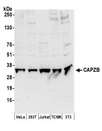 CAPZB / CAPZ Beta Antibody - Detection of human and mouse CAPZB by western blot. Samples: Whole cell lysate (50 µg) from HeLa, HEK293T, Jurkat, mouse TCMK-1, and mouse NIH 3T3 cells prepared using NETN lysis buffer. Antibodies: Affinity purified rabbit anti-CAPZB antibody used for WB at 0.1 µg/ml. Detection: Chemiluminescence with an exposure time of 30 seconds.