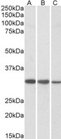 CAPZB / CAPZ Beta Antibody - CAPZB / CAPZ Beta antibody (0.01µg/ml) staining of Jurkat (A), HeLa (B) and NIH-3T3 (C) lysates (35µg protein in RIPA buffer). Detected by chemiluminescence.