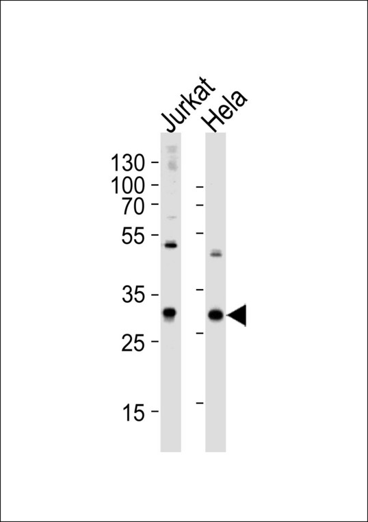 CAPZB / CAPZ Beta Antibody - Western blot of lysates from Jurkat, HeLa cell line (from left to right), using CAPZB Antibody. Antibody was diluted at 1:1000 at each lane. A goat anti-rabbit IgG H&L (HRP) at 1:5000 dilution was used as the secondary antibody. Lysates at 35ug per lane.