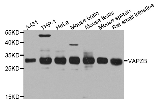 CAPZB / CAPZ Beta Antibody - Western blot analysis of extract of various cells.