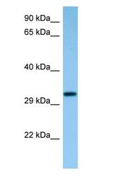 CAPZB / CAPZ Beta Antibody - CAPZ / CAPZB antibody Western Blot of Rat Small Intestine.  This image was taken for the unconjugated form of this product. Other forms have not been tested.