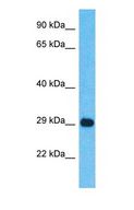 CAPZB / CAPZ Beta Antibody - Western blot of CAPZB Antibody with human 293T Whole Cell lysate.  This image was taken for the unconjugated form of this product. Other forms have not been tested.