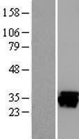 CAPZB / CAPZ Beta Protein - Western validation with an anti-DDK antibody * L: Control HEK293 lysate R: Over-expression lysate