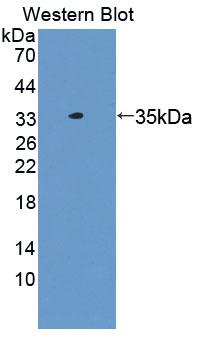 Carboxylesterase 1 / CES1 Antibody - Western blot of Carboxylesterase 1 / CES1 antibody.