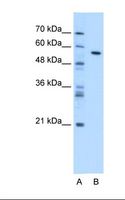 Carboxylesterase 1 / CES1 Antibody - Lane A: Marker. Lane B: Transfected 293T cell lysate. Antibody concentration: 1.25 ug/ml. Gel concentration: 12%.  This image was taken for the unconjugated form of this product. Other forms have not been tested.