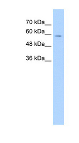 Carboxylesterase 1 / CES1 Antibody - CES1 antibody ARP41878_T100-NP_001020365-CES1(carboxylesterase 1 (monocyte/macrophage serine esterase 1)) Antibody Western blot of PANC1 cell lysate.  This image was taken for the unconjugated form of this product. Other forms have not been tested.