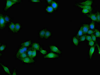 Carboxylesterase 1 / CES1 Antibody - Immunofluorescent analysis of HepG2 cells using CES1 Antibody at dilution of 1:100 and Alexa Fluor 488-congugated AffiniPure Goat Anti-Rabbit IgG(H+L)