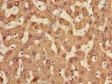 Carboxylesterase 1 / CES1 Antibody - Immunohistochemistry of paraffin-embedded human liver tissue using CES1 Antibody at dilution of 1:100