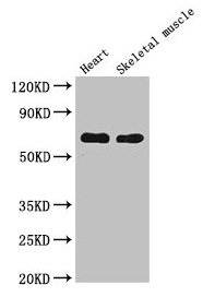 Carboxylesterase 1 / CES1 Antibody - Western Blot Positive WB detected in: Mouse heart tissue, Mouse skeletal muscle tissue All lanes: CES1 antibody at 5µg/ml Secondary Goat polyclonal to rabbit IgG at 1/50000 dilution Predicted band size: 63 kDa Observed band size: 63 kDa