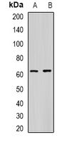 Carboxylesterase 1 / CES1 Antibody - Western blot analysis of CES1 expression in A549 (A); mouse liver (B) whole cell lysates.