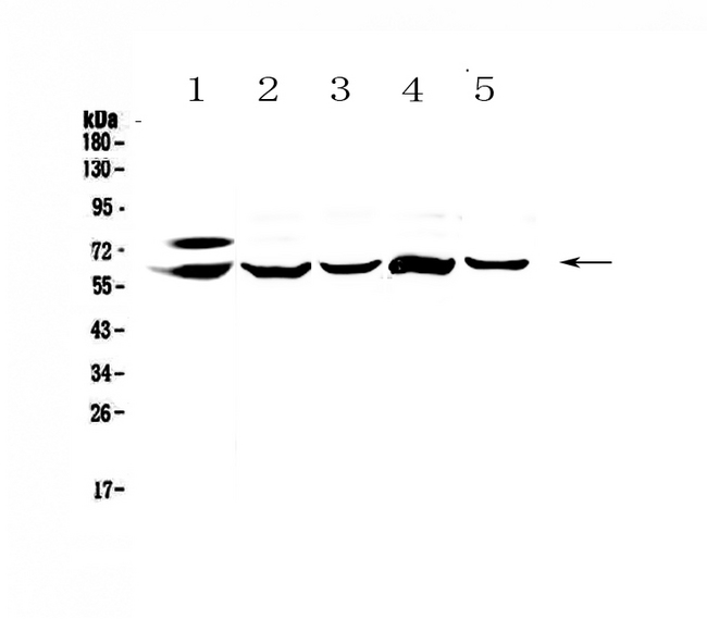 Carboxylesterase 1 / CES1 Antibody - Western blot - Anti-CES1 Picoband antibody